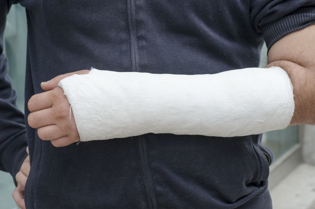 man with an injury in a cast after an accident